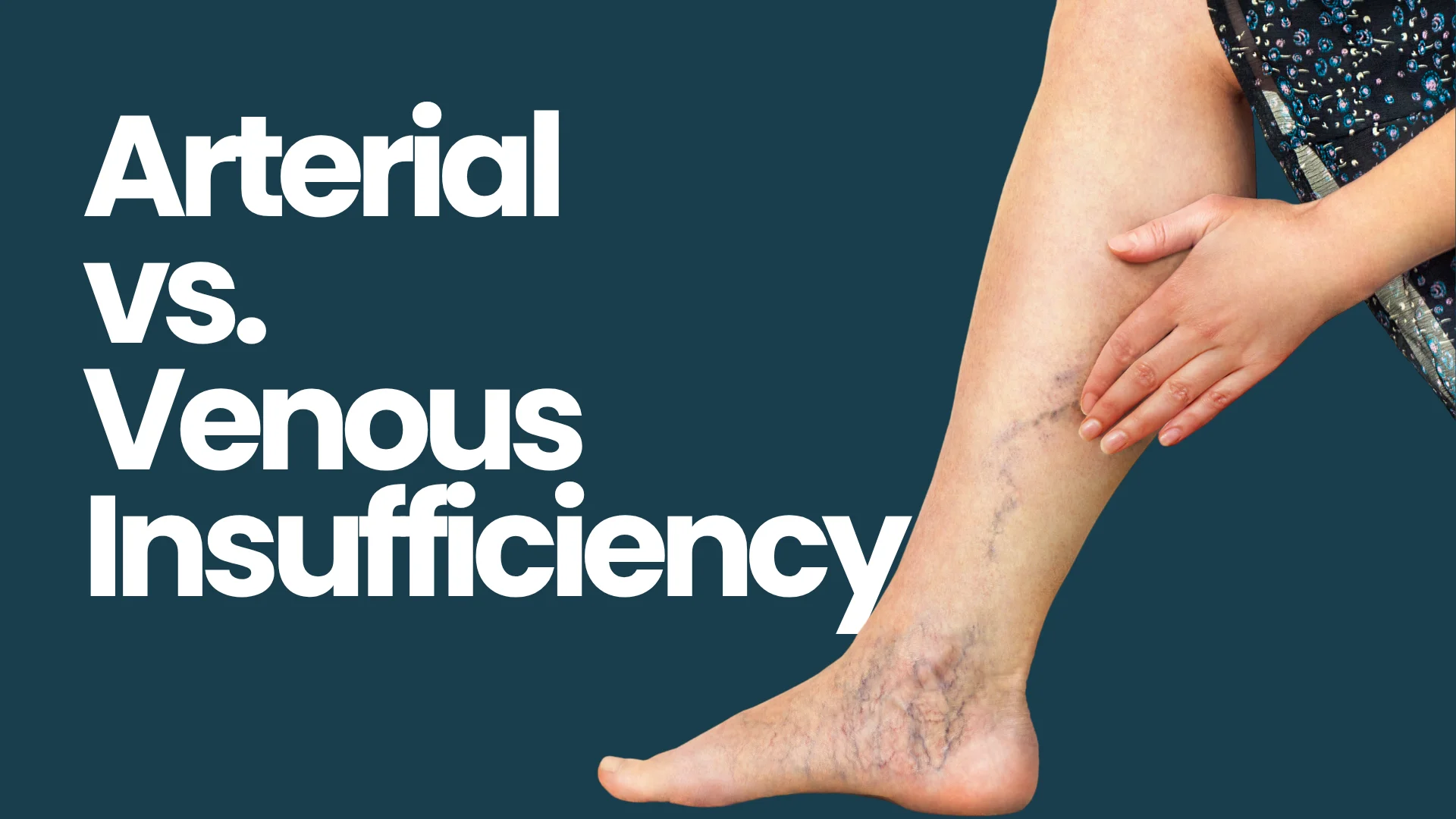 Arterial vs. Venous Insufficiency