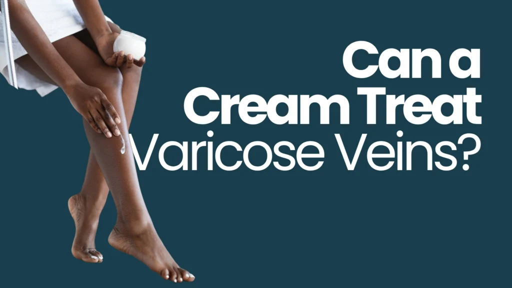 Can a Cream Treat Varicose Vein