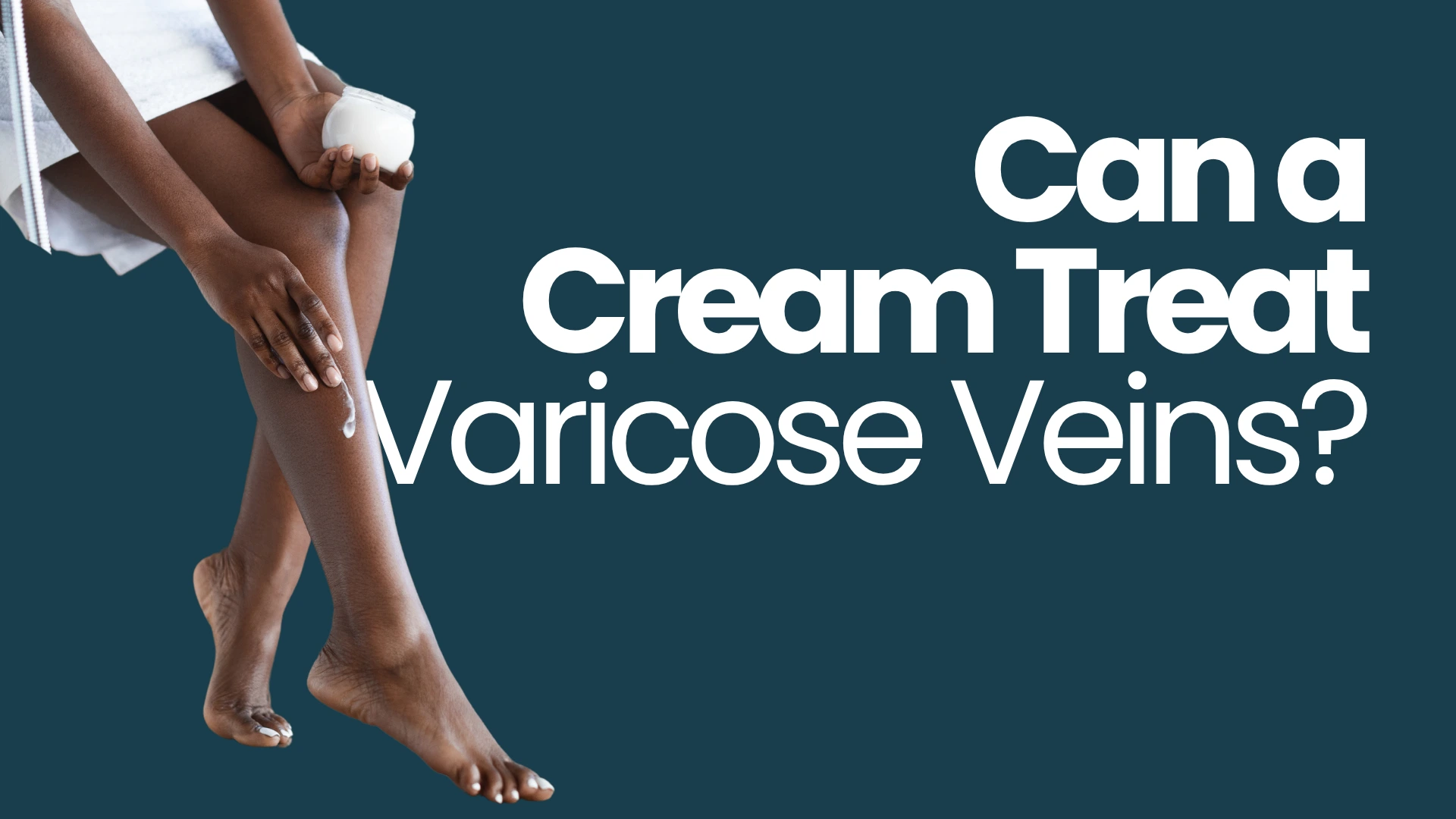 Can a Cream Treat Varicose Vein