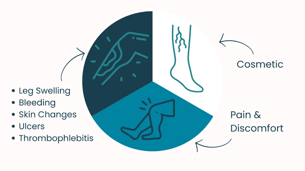 Varicose Veins Concerns