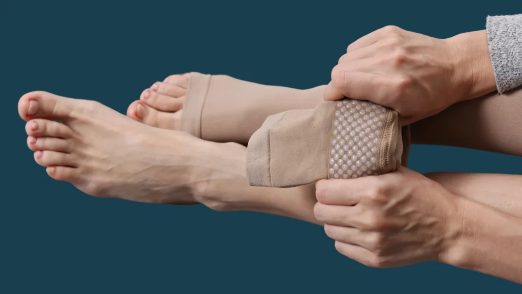 Aftercare of Radiofrequency Ablation