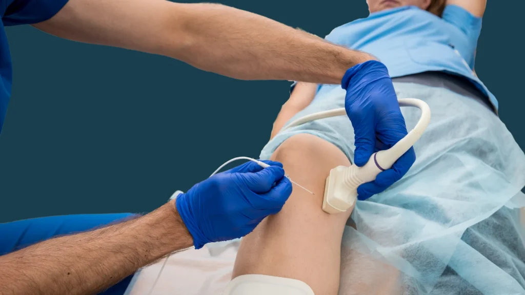 What is Radiofrequency Ablation