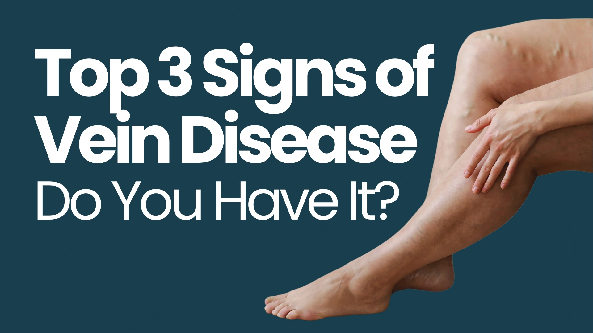 Top 3 Signs of Vein Disease