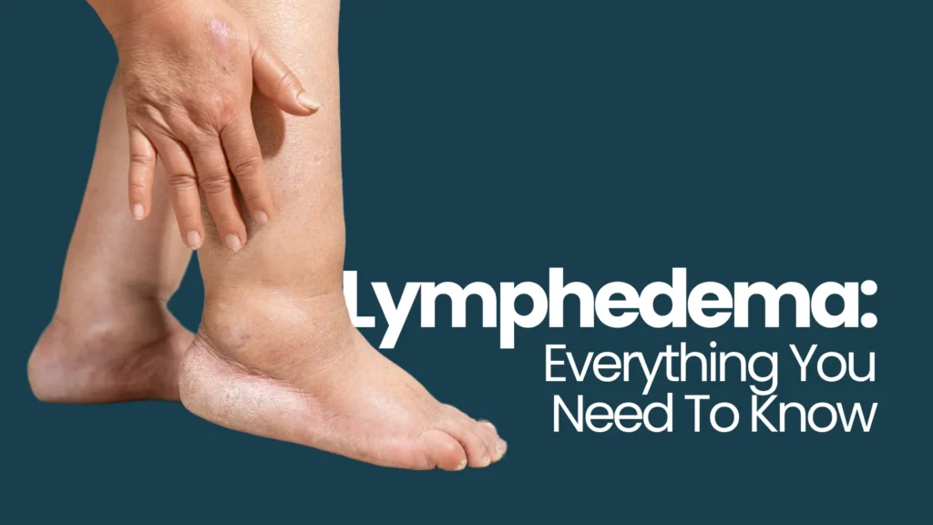 Lymphedema Everything You Need To Know