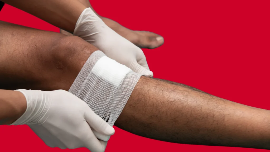 Medical Treatment for Venous Ulcers