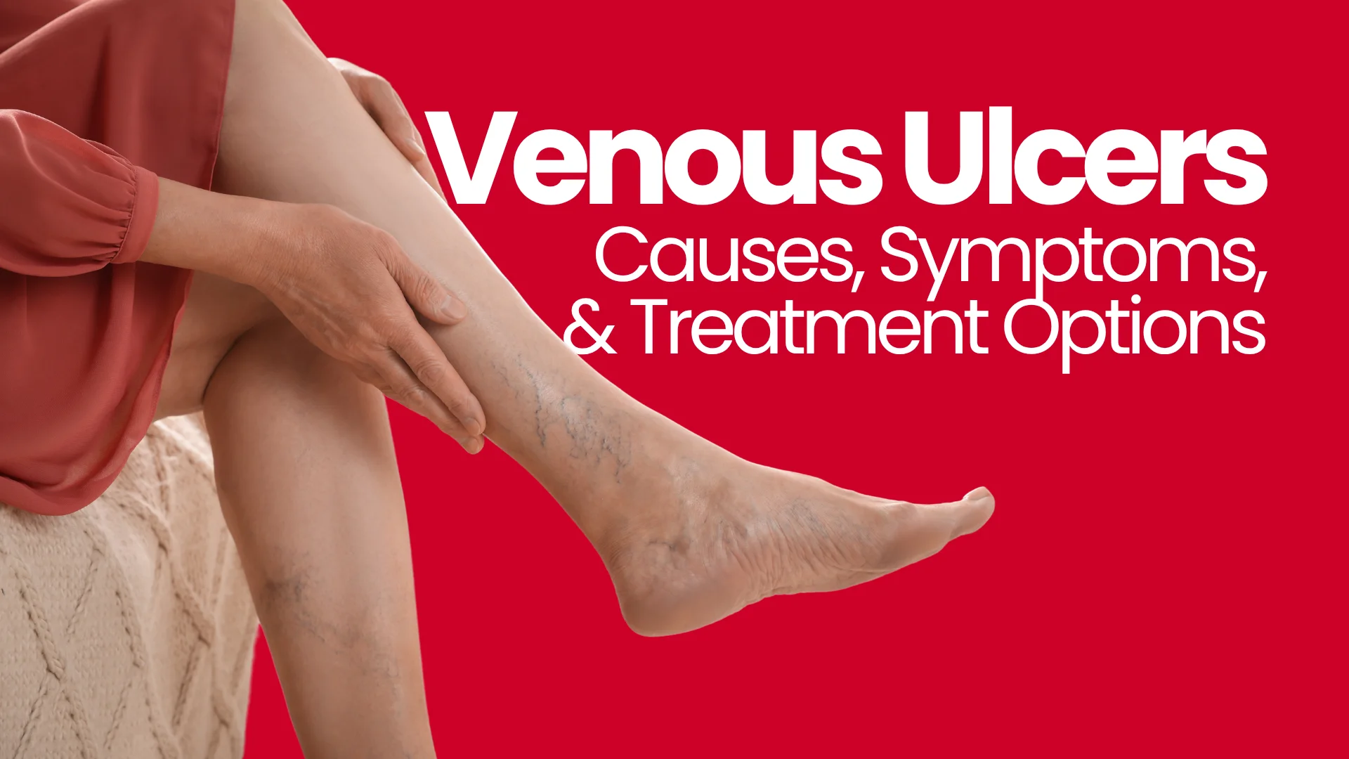 Venous Ulcers