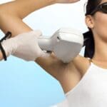 Laser Hair Removal