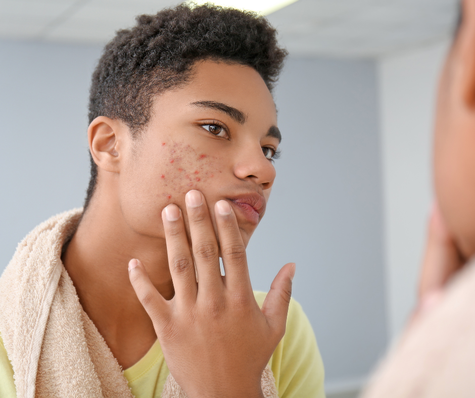 Man with spots on cheek