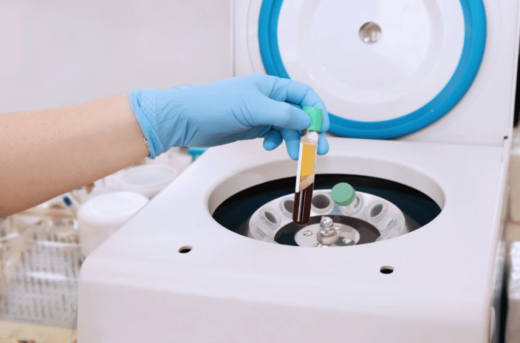 PRP machine