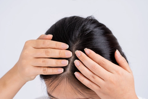 hair restoration